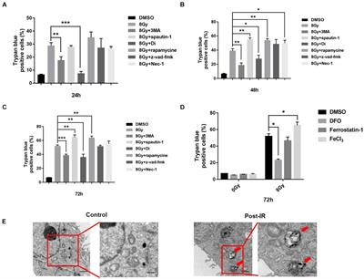 Iron-Dependent Autophagic Cell Death Induced by Radiation in MDA-MB-231 Breast Cancer Cells